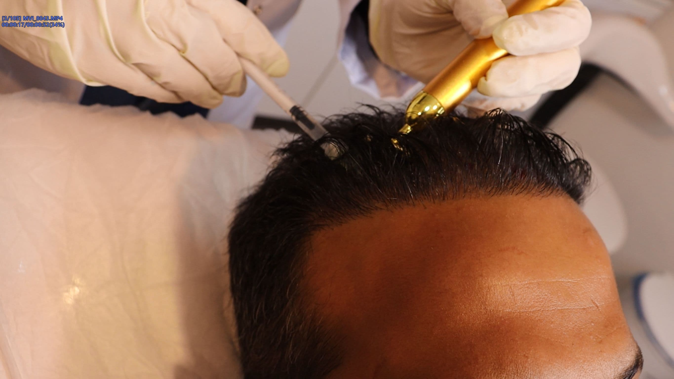 روش های جلوگیری از ریزش مو و ترمیم آن